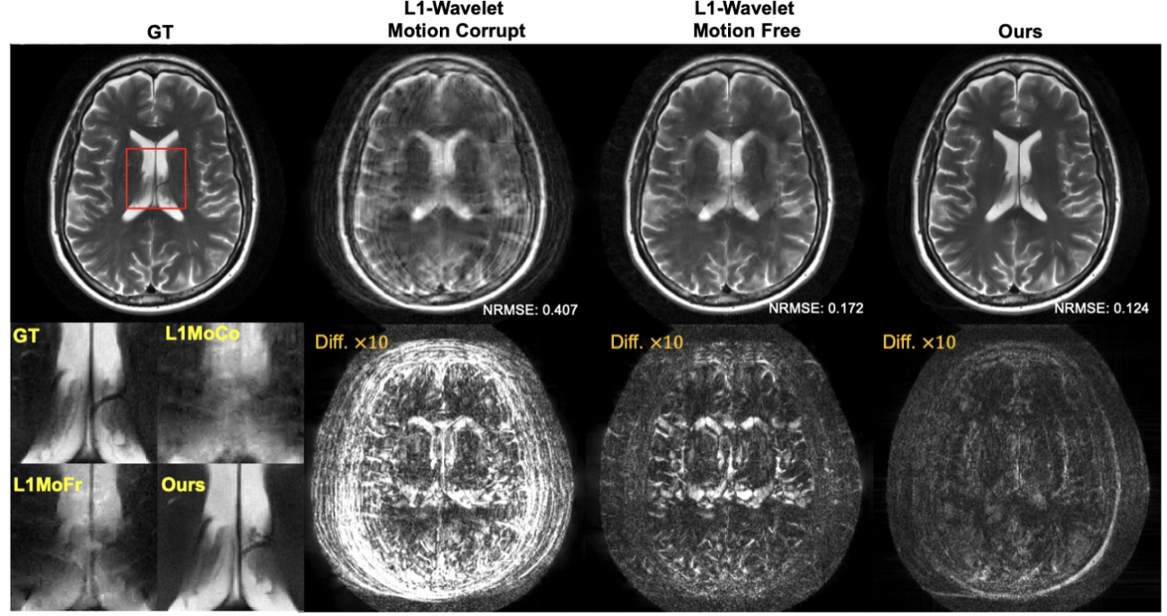 Foundations of Medical Imaging-